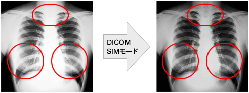 陰影強いDICOM SIMモードを搭載(注１)