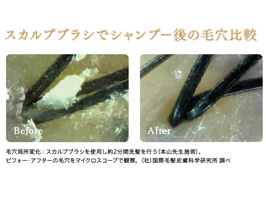 イメージ:Point(4)ボリューム感は毛髪の 美しさで決まる