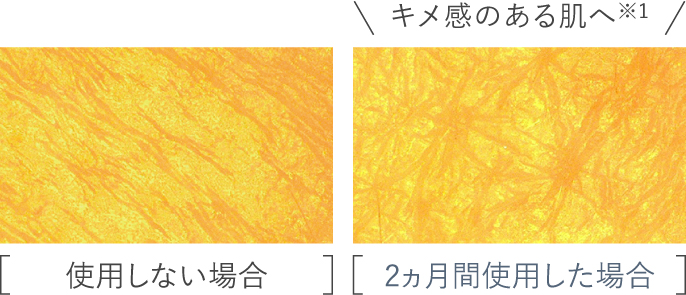 肌の写真：使用しない場合と比較して、2か月間使用した場合の方がキメ感がある