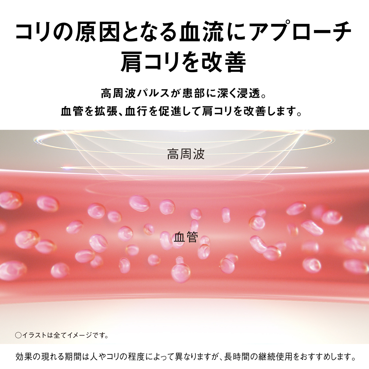 EW-RA520-K_画像4
